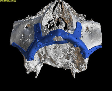 VANEGAS MARIA INES0-3D View.jpg