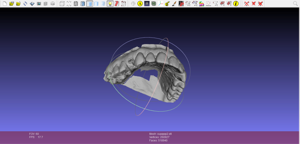 DIGITALIZACIÓN EN 3D DE MODELOS DE YESOS