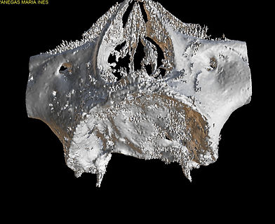 VANEGAS MARIA INES2-3D View.jpg