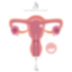 งาน-Siam-Fertility_200215_0060-1024x1024.jpg