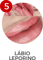 Micropigmentação Labial