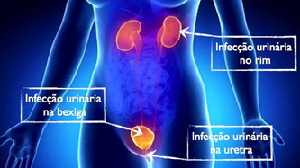 Doenças dos Rins e Vias Urinárias