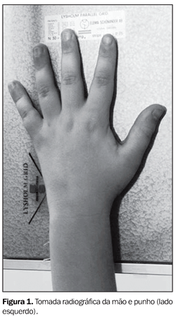 TOMADA_RADIOGRAFICA_MÃO_E_PUNHO
