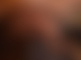 Scalp Micropigmentation for Women: You Don’t Have to Accept Thinning Hair