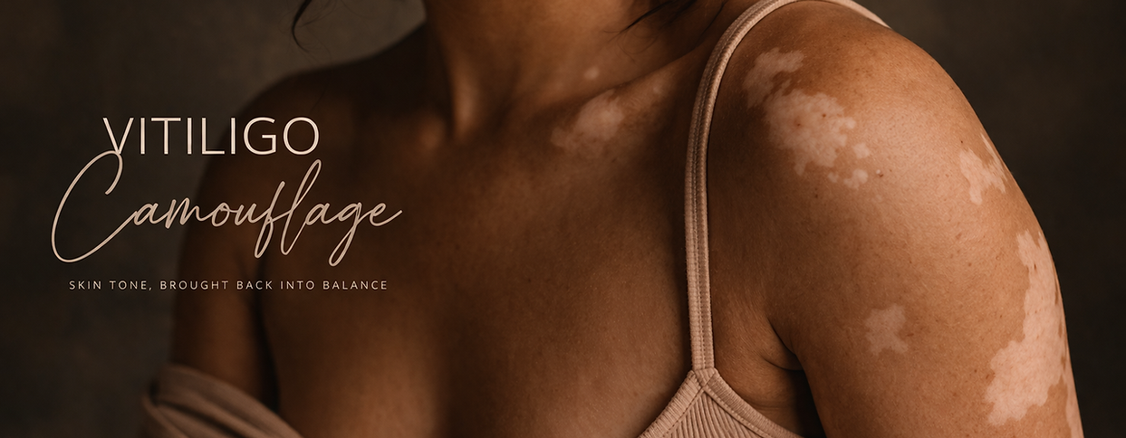 Vitiligo camouflage showing natural skin with uneven pigmentation in soft, warm lighting.p