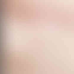 southern california scar camouflage medical tattoos for tummy tuck scars rancho cucamonga irvine california