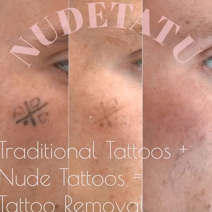 tattoo removal redlands ca nudetatu