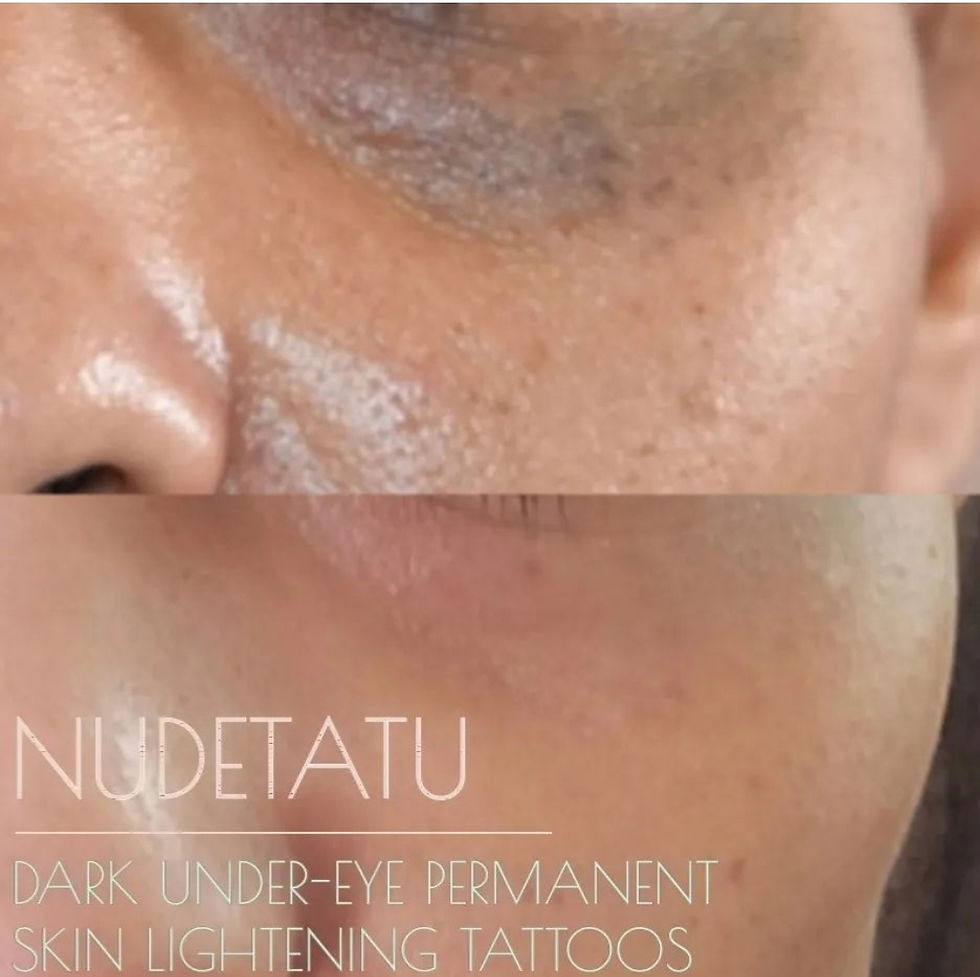 "NUDETATU Redlands, CA: Permanent Makeup Under-eye Concealer" before and after