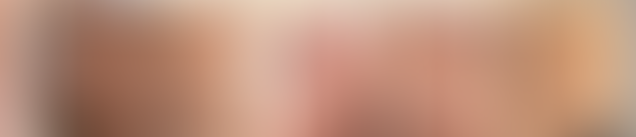 Fade Away Imperfections: The Power of Inkless Scar Camouflage Medical Tattoos