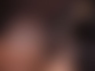 Scalp Micropigmentation in Redlands, CA: What to Expect