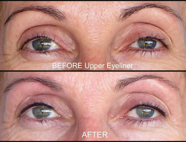 before and after upper eyelid eyeliner tattoo redlanda ca nudetatu.jpg