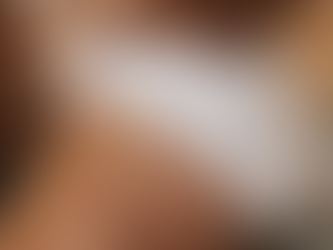 Embrace Your Skin: Transforming Stretch Marks into Confidence with Southern California Scar Camouflage Medical Tattoos