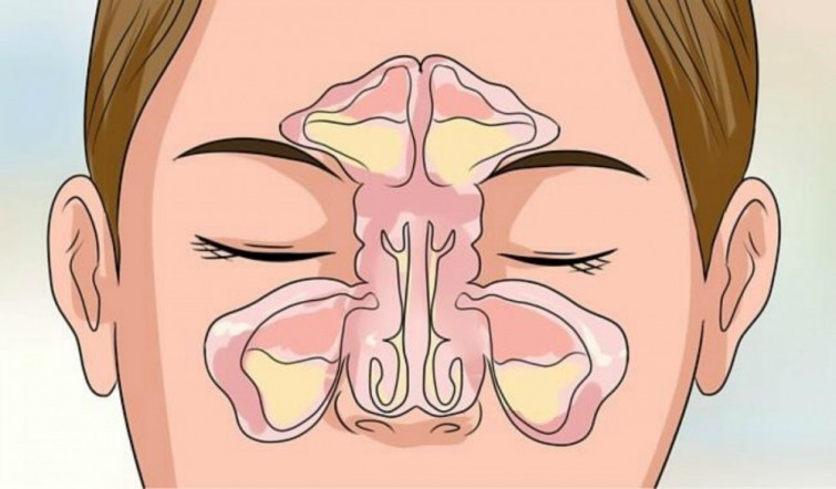 Oreja congestionada por una semana