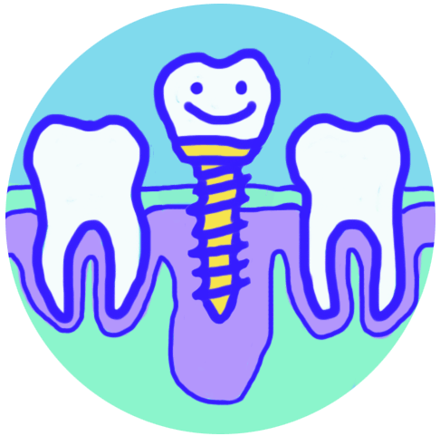 S-IMPLANTES.gif