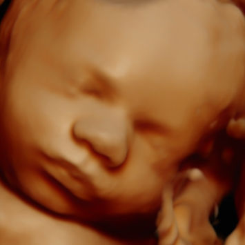 Échographie 3D 4D 5D bébé profil droit gros plan Montréal Bébévizion / 3D 4D 5D baby right profile close-up ultrasound Montreal Bébévizion