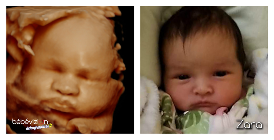 Marie-Michelle Sarasin Bébé Zara.png