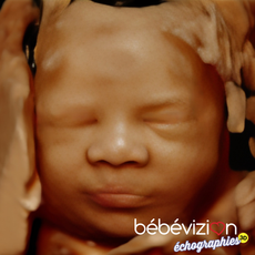 bebevizion echographie 3D 4D ultrasound
