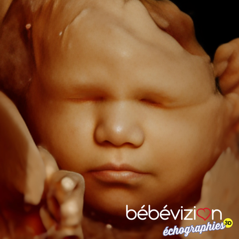 Échographie 3D 4D 5D bébé profil Montréal Bébévizion / 3D 4D 5D baby profile ultrasound Montreal Bébévizion