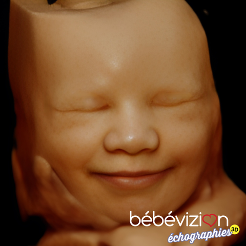 Échographie 3D 4D 5D visage bébé réaliste Montréal Bébévizion / 3D 4D 5D realistic baby face ultrasound Montreal Bébévizion