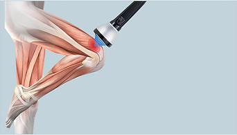 knee .jpg
