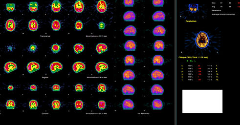 Schermafbeelding 2019-08-05 om 09.57_edited.jpg