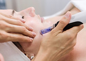 A woman undergoing a microneedling treatment on her face