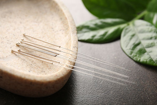 Acupuncture needles on a stone tray