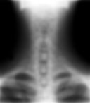 Cervical_Xray_Lower_AP_View.jpg