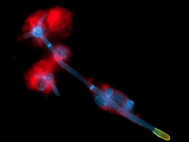 How Our Immune System Keeps Candida albicans in Check