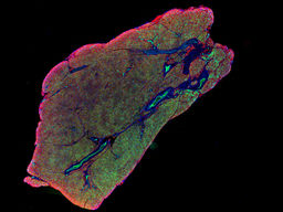 우리 몸의 발열 조직, 갈색 지방의 에너지 연소 원리