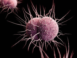 임질(Gonorrhea)에 대한 새로운 항생제