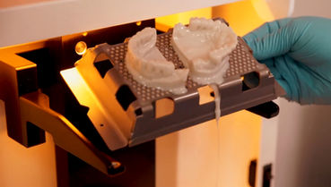 Impressão 3D na Odontologia: Como Próteses Monolíticas Estão Revolucionando Laboratórios Dentais