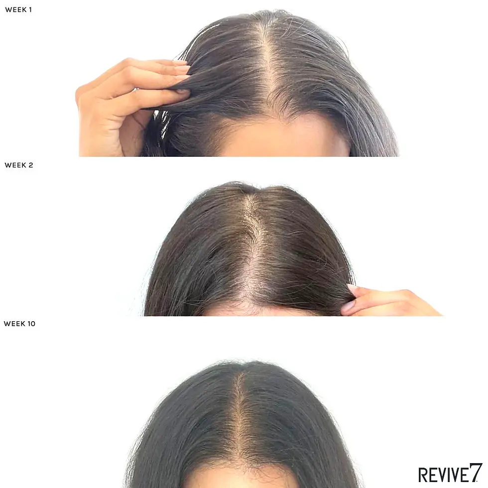 Thumbnail: Revive7 Hair Oil