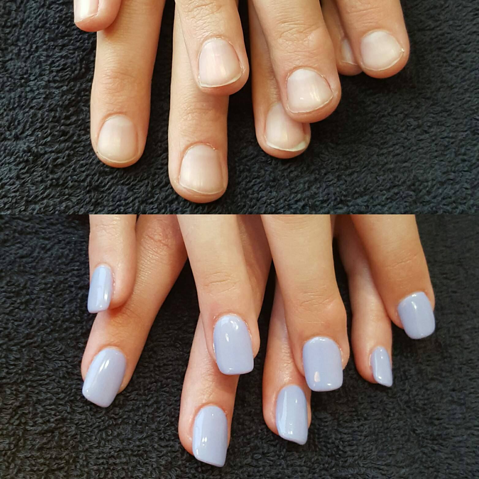 Before and After