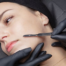 Dermaplaning facial