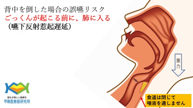 背中を倒した場合嚥下反射惹起遅延.gif