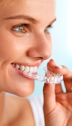 alinhadores-esteticos-ortodonticos-esthetic-aligner-ortodontia-com-alinhadores_edited.jpg