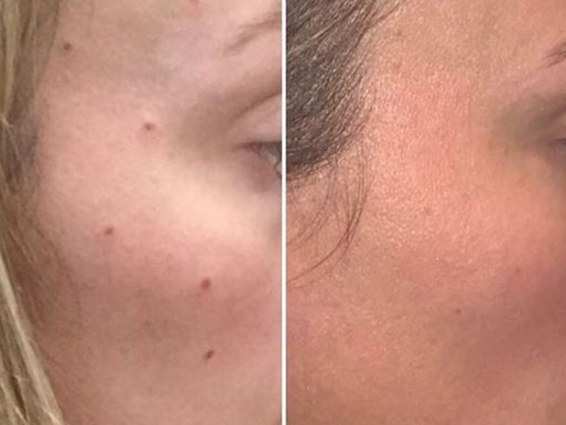 Skin clinic remodelling results in Stamford