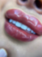 The Satin Lip Blush treatment is the perfect way to restore shape and fullness lost age and transform thin or uneven lips