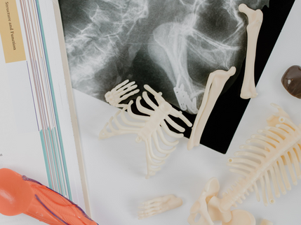 8 Kebiasaan yang Dapat Mengganggu Kesehatan Tulang