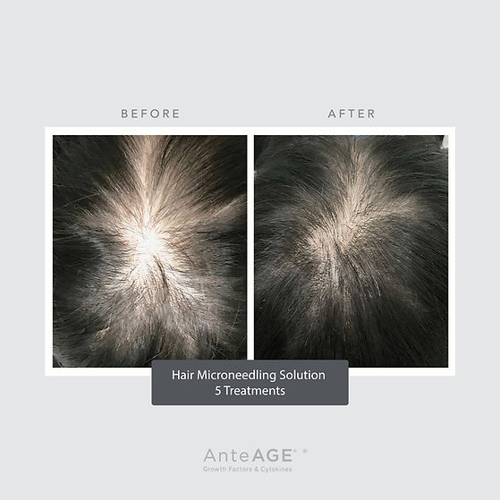 AnteAGE MD Hair B+A Feed Post.jpg