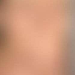 What is Nano Brows technique?