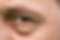 cernes et poches sous les yeux