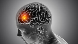 AVC DE L’ŒIL LILLE, AVC OCULAIRE, INFARCTUS OCULAIRE