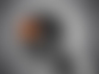 AVC DE L’ŒIL LILLE, AVC OCULAIRE, INFARCTUS OCULAIRE
