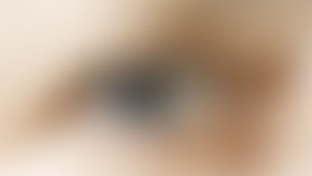 opération des paupières tombantes à Lille