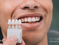 4-teeth-whitening-sample-colours-peakstock-science-photo-library.jpg