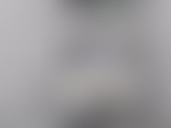 Ultrasonido Premium, modelo SPECTRA VST, marca DIASONICS, s. XX