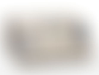 Analizador de polarización, sistema de fluorescencia automatizada, ABBOTT TDX FLX®, s. XXI