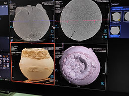 IMG-20220514-WA0040 (1).jpg